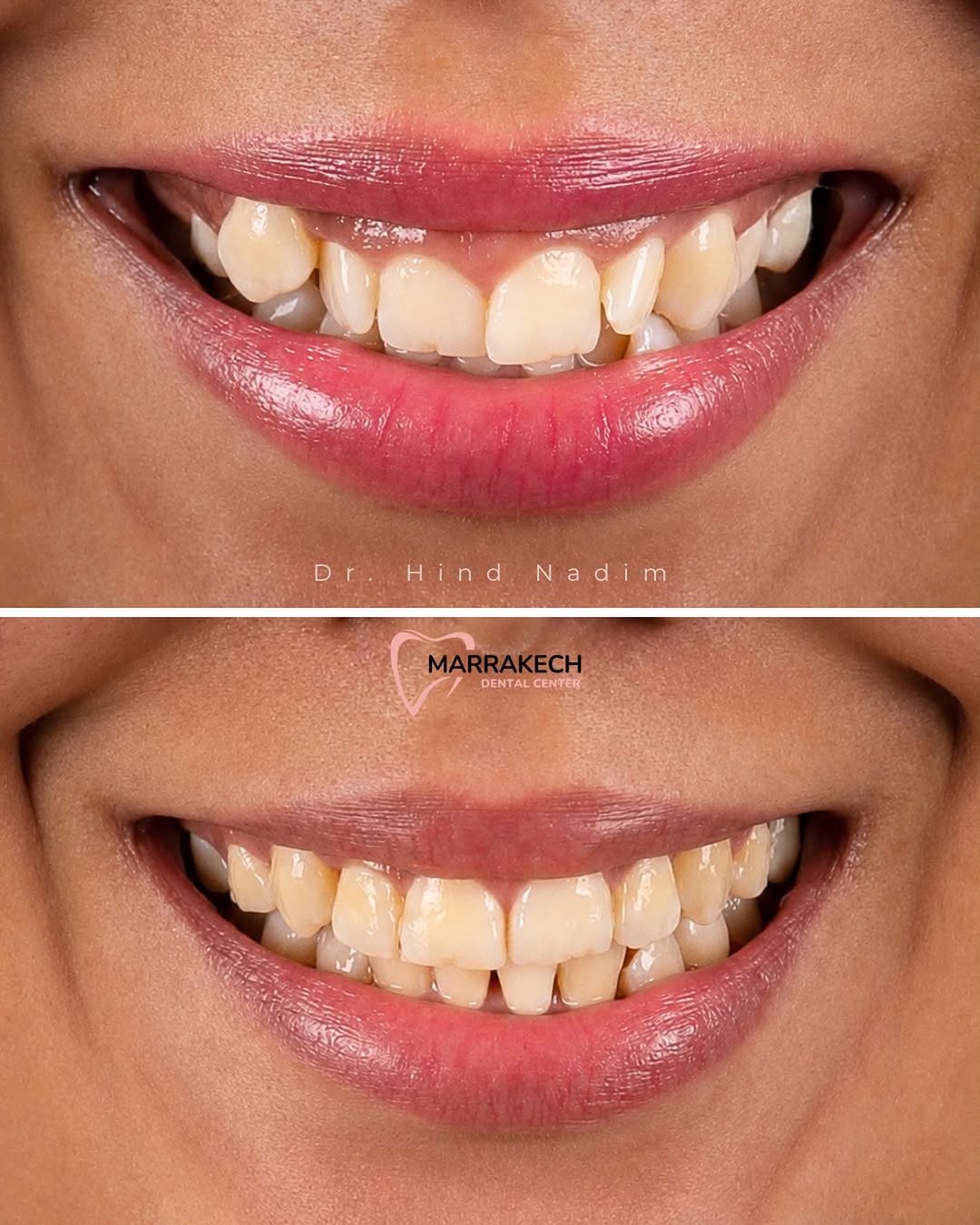 Publication Instagram du Dr Hind Nadim